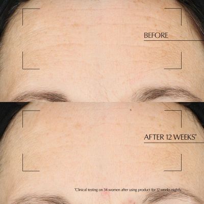 ESTÉE LAUDER Advanced Night Repair Overnight Treatment Night cream