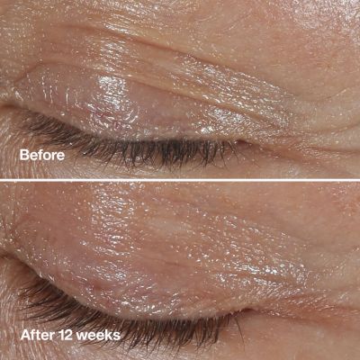 CLINIQUE Smart Clinical Repair Firming eye cream