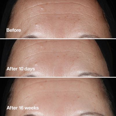 CLINIQUE Smart Clinical Repair Wrinkle Correcting Serum Stangrinamasis veido serumas
